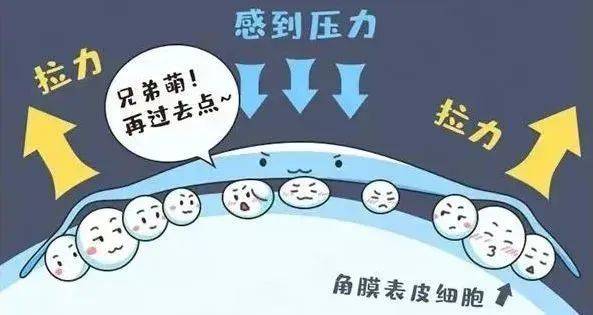 孩子近视<strong></p>
<p>近视镜</strong>，框架镜、离焦镜、OK镜怎么选:近视镜