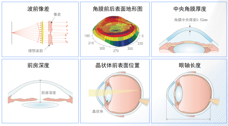 近视20年终摘镜：全光塑技术中年近视+老花难题:近视镜