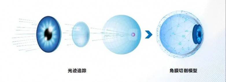 近视20年终摘镜：全光塑技术破解中年近视+老花难题:近视镜