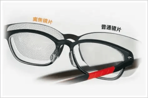 阿托品、OK镜、离焦镜是什么<strong></p>
<p>近视镜</strong>？必须用吗？近视后应该怎么防控？:近视镜