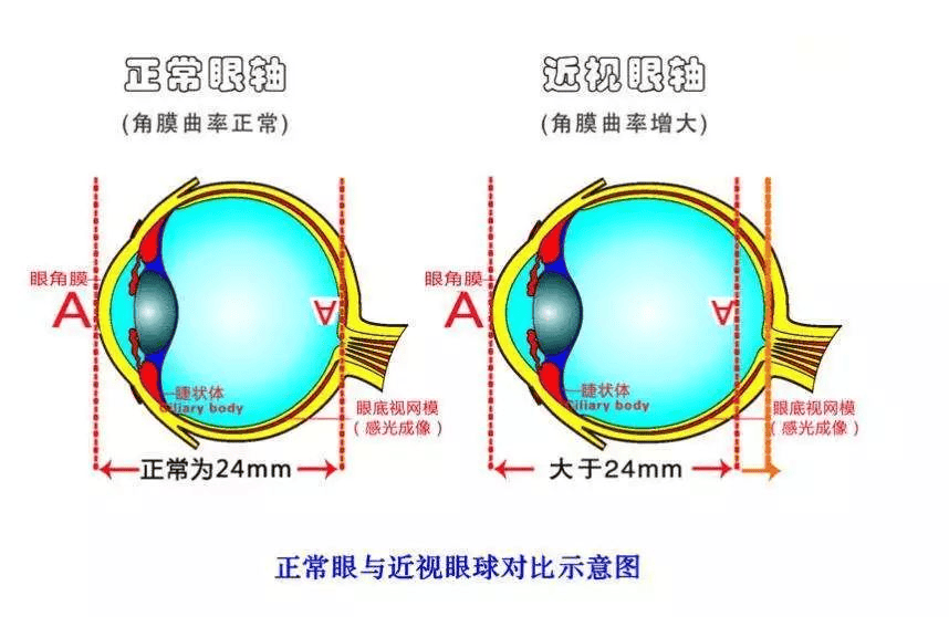 武汉普瑞眼科可视化近视手术好吗<strong></p>
<p>近视镜</strong>？近视专家关念送你摘镜攻略:近视镜