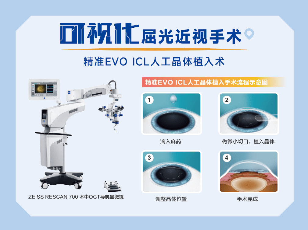 安心摘镜我有谱｜关念送你五一摘镜攻略：可视化近视手术怎么选<strong></p>
<p>近视镜</strong>？:近视镜