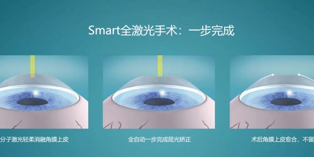 2025杭州秋季征兵摘镜攻略<strong></p>
<p>近视镜</strong>，近视小伙伴必看！:近视镜